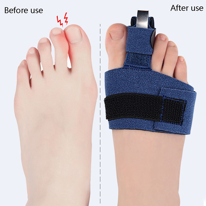 1 Peça Corretor de Dedos do Pé - Ankle Brace Sock avaliação e preço